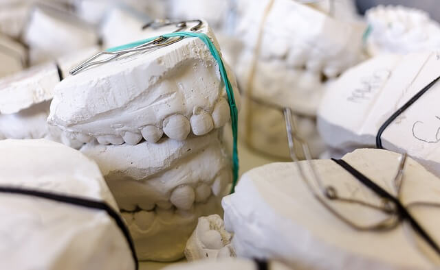Wycisk zęba do korony porcelanowej